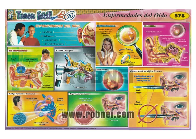 Enfermedades-Del-Oido-578